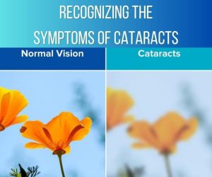 Cataracts Symptom visual