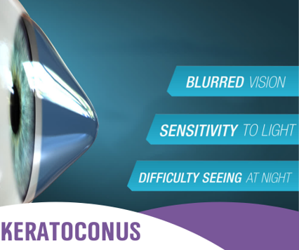 Keratoconus Graphic